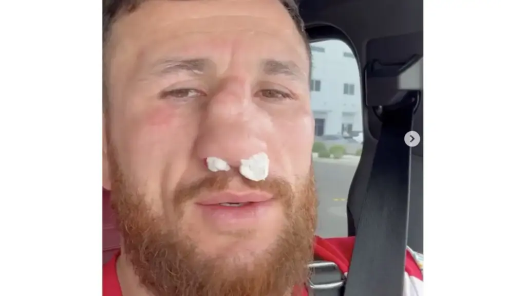 Merab Dvalishvili Breaks Nose in Training, Posts Graphic Video